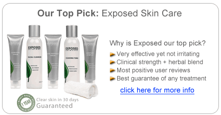Exposed Skin Care